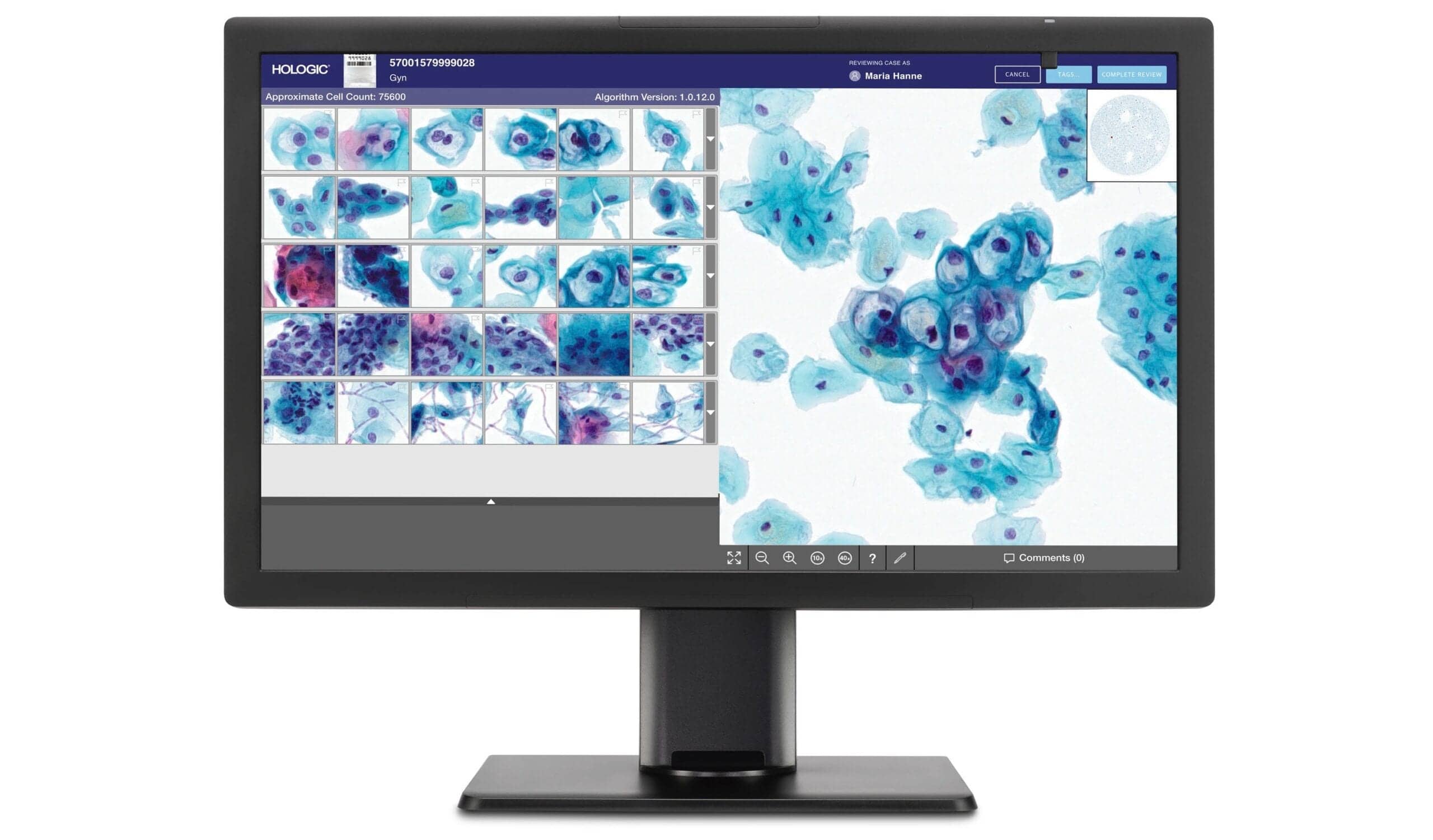 Genius™ Digital Diagnostics